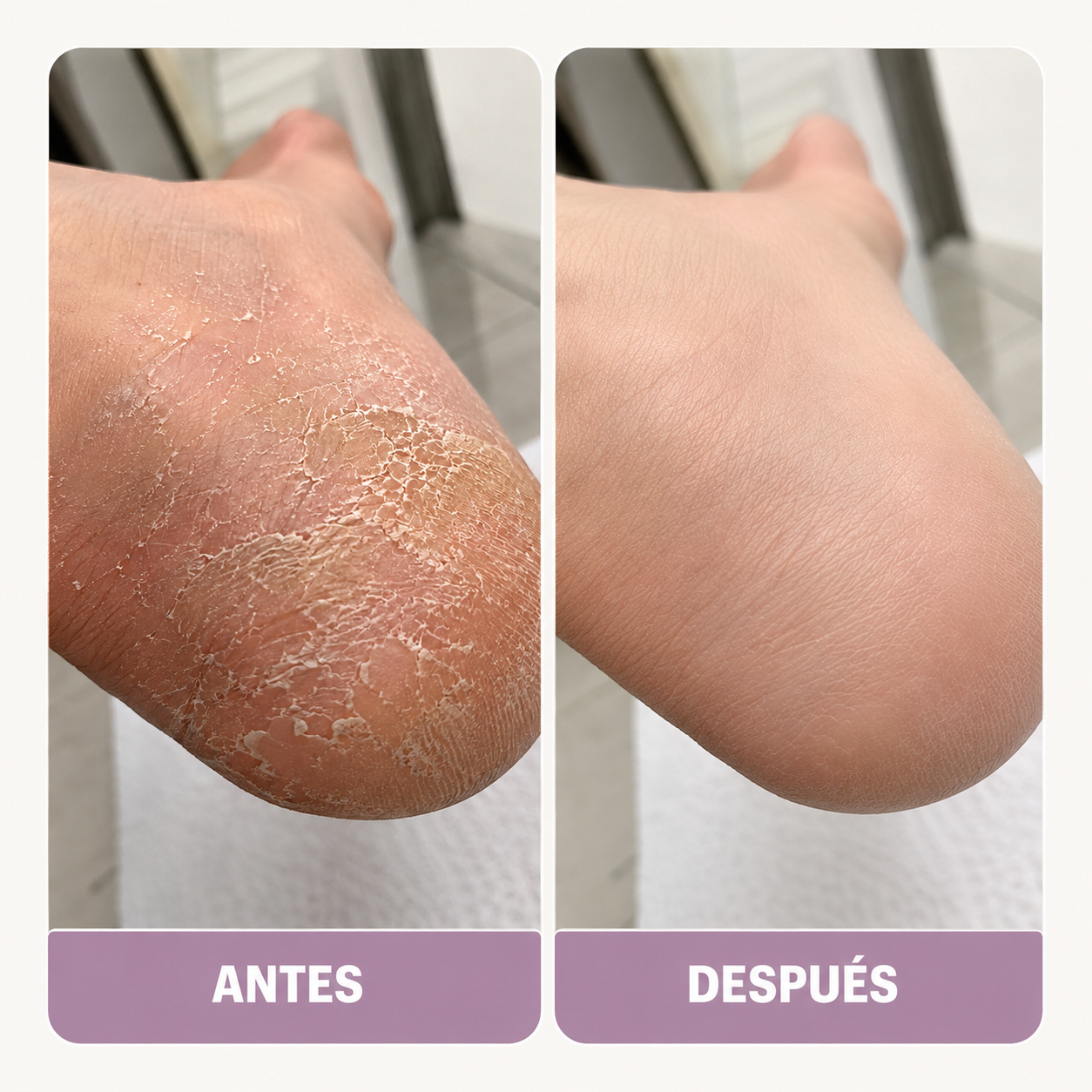 Talones mucho más suaves