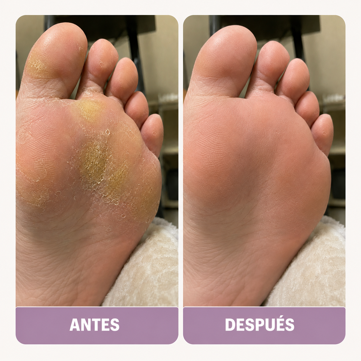 Resultado visible desde el primer uso