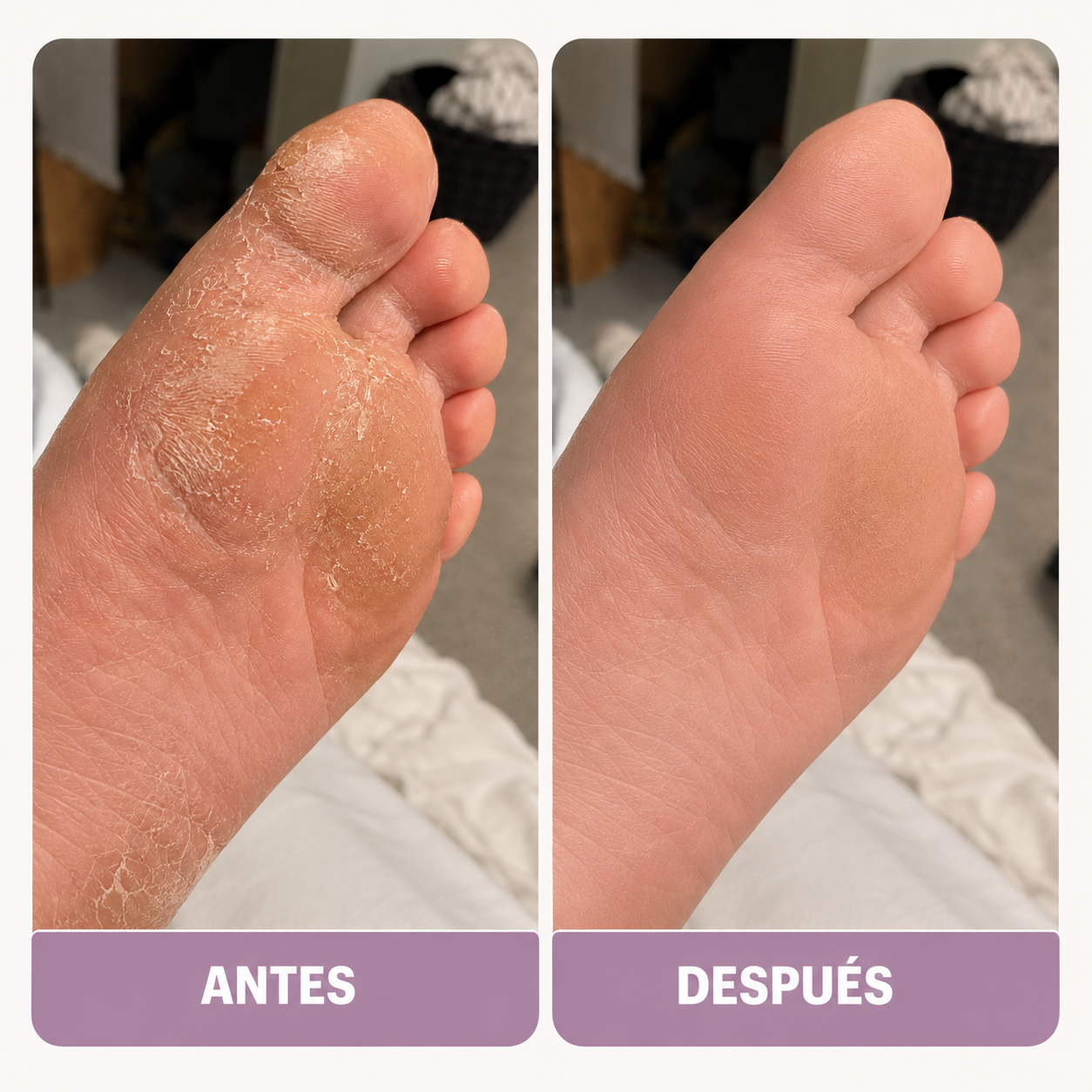 Perfecto para mantener los pies cuidados