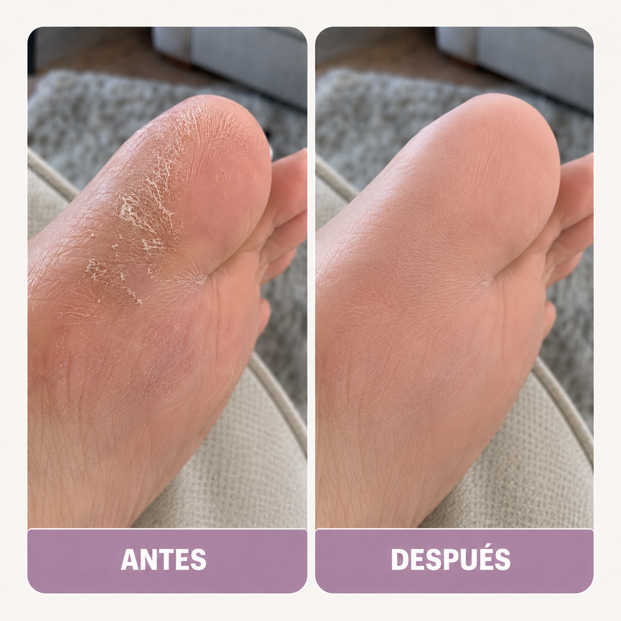 La piel muerta sale rápido